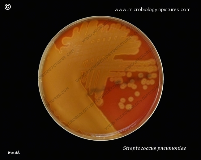 streptococcus pneumoniae, strong hemolysis